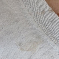 Object thrown from passing train hits my wife on the chest.